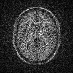 Noisy MRI brain scan